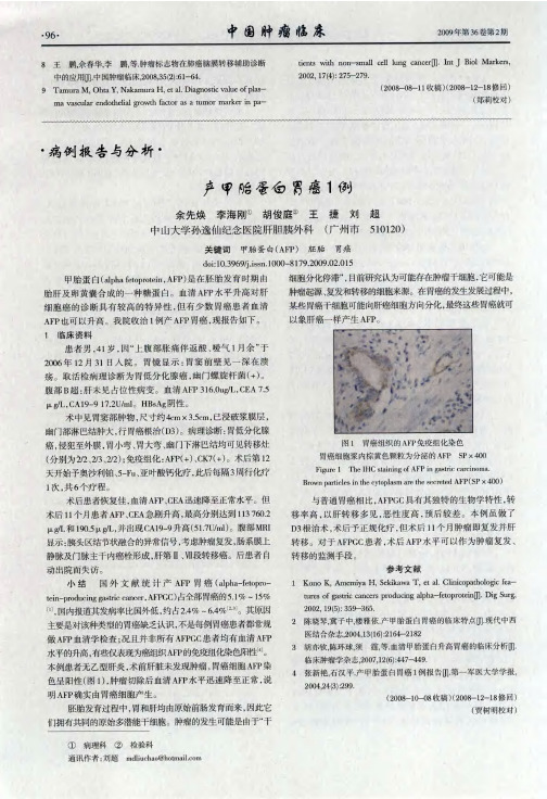 产甲胎蛋白胃癌1例