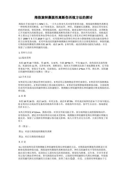拇指旋转撕脱性离断伤再植方法的探讨