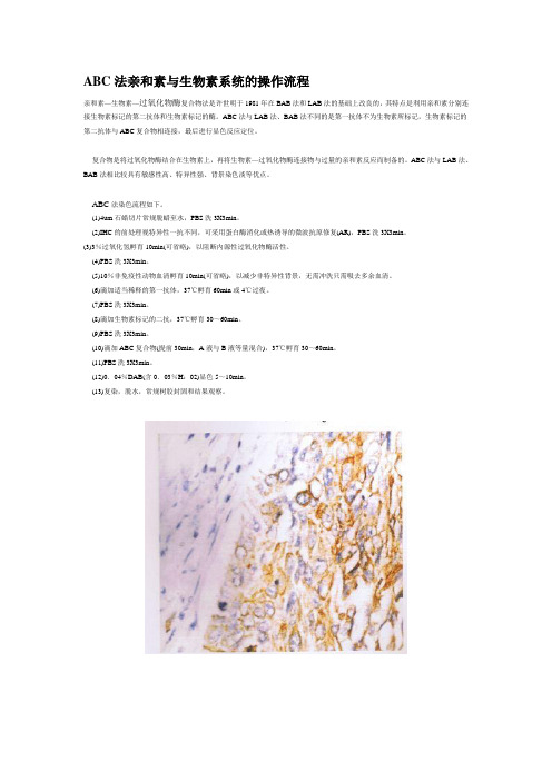 ABC法亲和素与生物素系统的操作流程