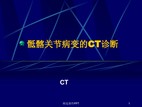 骶髂关节病变的CT诊断ppt课件