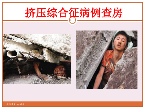 挤压综合征的护理查房