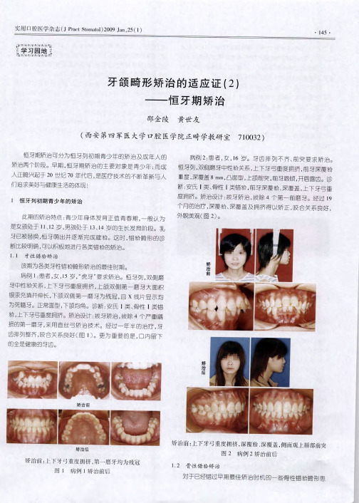 牙颌畸形矫治的适应证(2)——恒牙期矫治