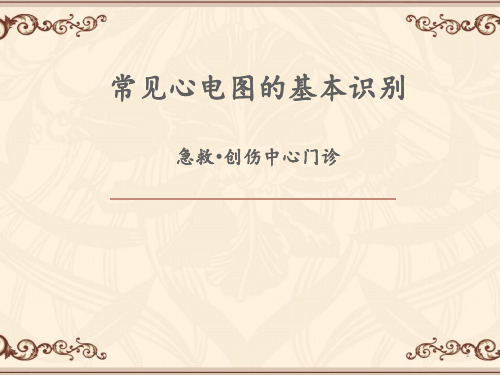 常见心电图的基本识别  ppt课件