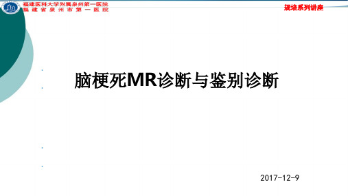 脑梗死MR诊断及鉴别诊断