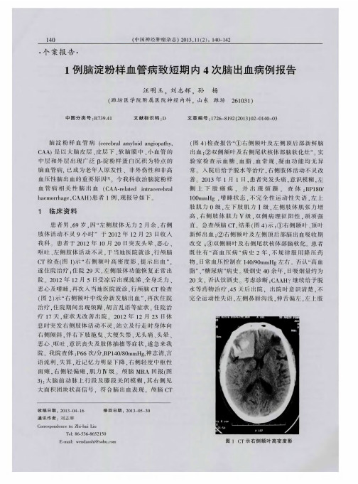 1例脑淀粉样血管病致短期内4次脑出血病例报告