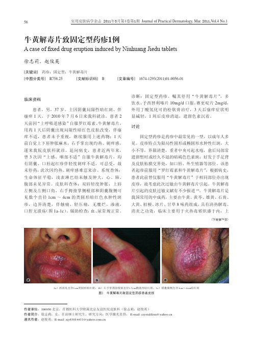 牛黄解毒片致固定型药疹1例