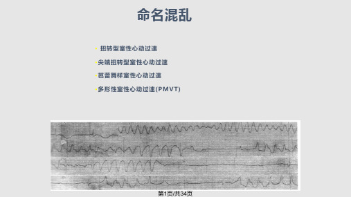 扭转型室性心动过速PPT课件