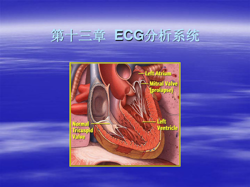 数字信号处理 ECG分析系统