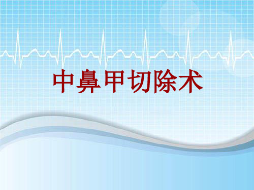 手术讲解模板：中鼻甲切除术