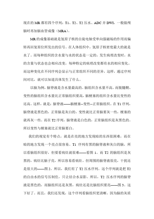 头颅核磁四张片各为了什么看