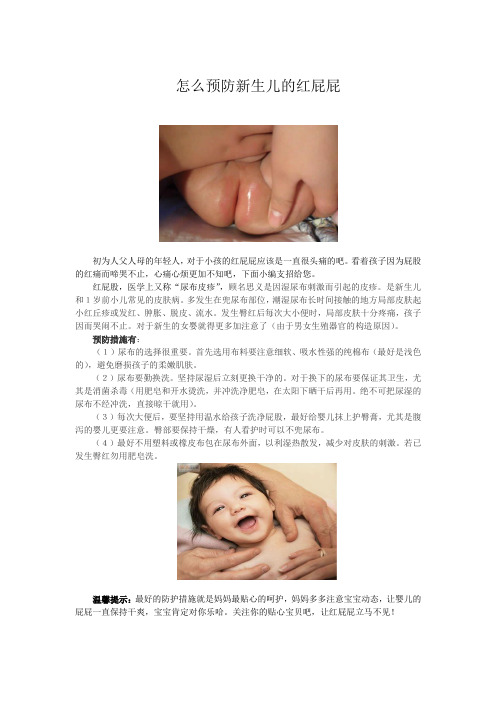 怎么预防新生儿的红屁屁