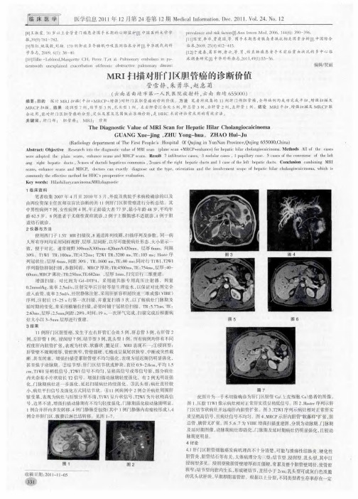 MRI扫描对肝门区胆管癌的诊断价值