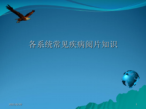 各系统常见疾病阅片知识 课件