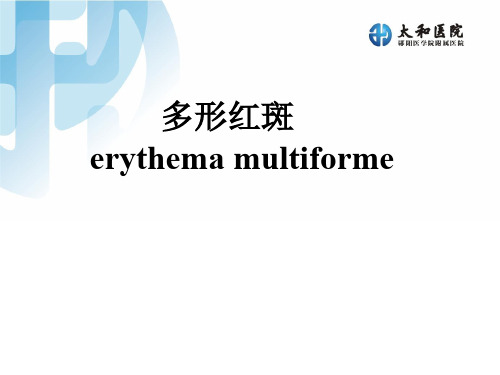 【皮肤性病学】多形红斑PPT课件