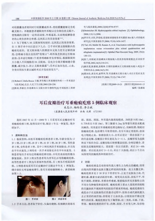 耳后皮瓣治疗耳垂瘢痕疙瘩5例临床观察
