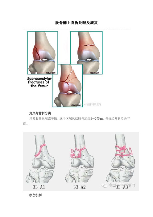 股骨髁上骨折处理及康复