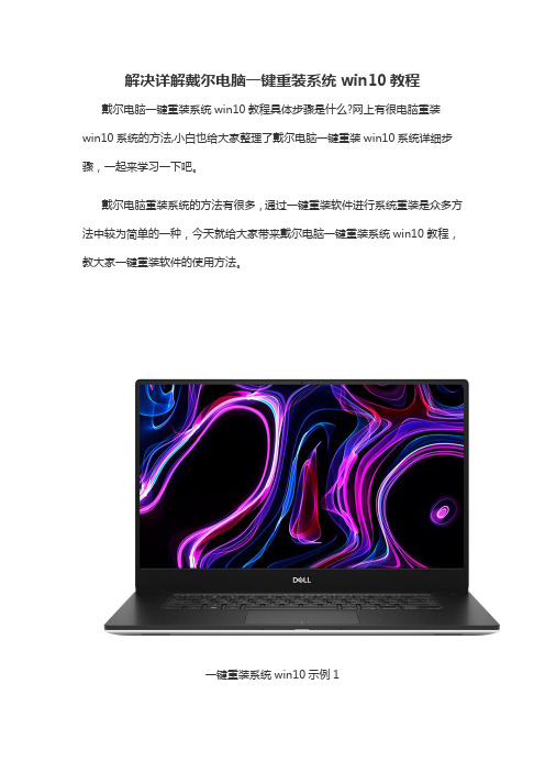 解决详解戴尔电脑一键重装系统win10教程