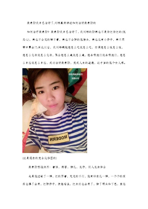 激素脸我自己治好了,刘婷真实讲述如何治好激素脸的
