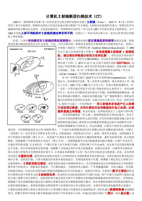 计算机X射线断层扫描技术CT