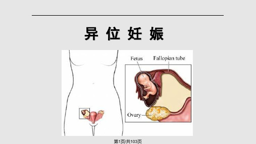 病理妊娠教学片PPT课件
