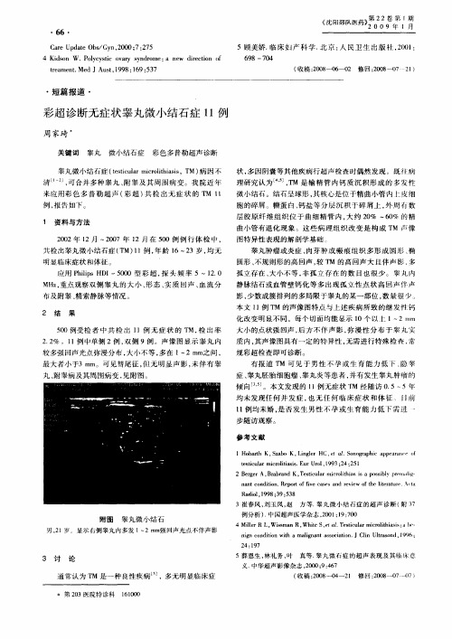 彩超诊断无症状睾丸微小结石症11例