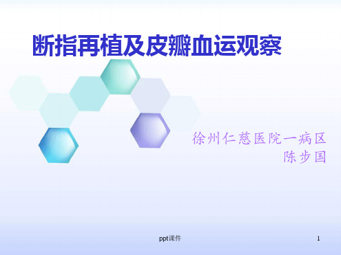 断指再植及血运观察 课件