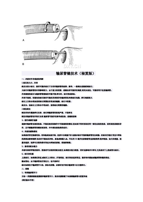 输尿管镜技术(秘笈版)
