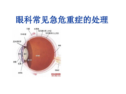 眼科急危重症的处理院前急救-五官科