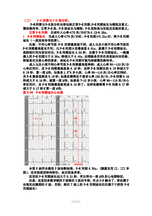 另类心电图学讲义5--P-R段与P-R间期Word版