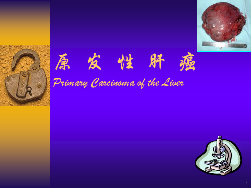 原发性肝癌ppt课件