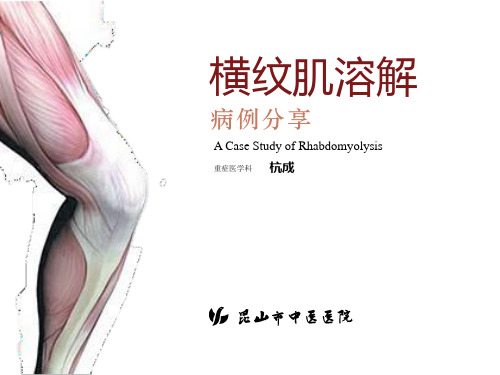 右美托咪定的应用病例分享 - 横纹肌溶解