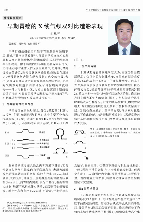 早期胃癌的X线气钡双对比造影表现