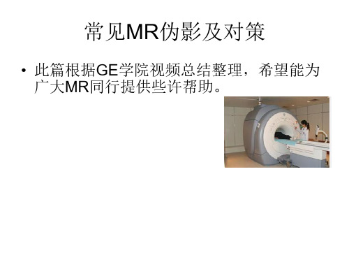 医学影像-常见MR伪影及对策