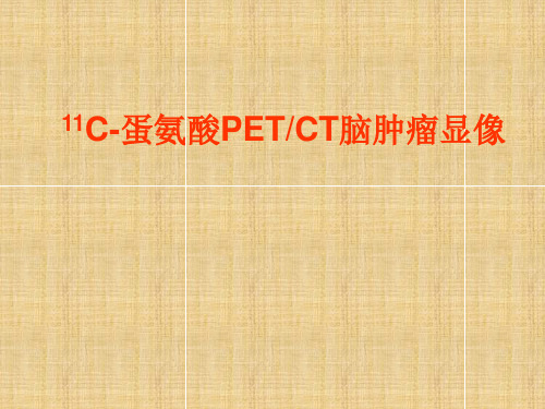 11C-蛋氨酸PET-CT脑肿瘤显像