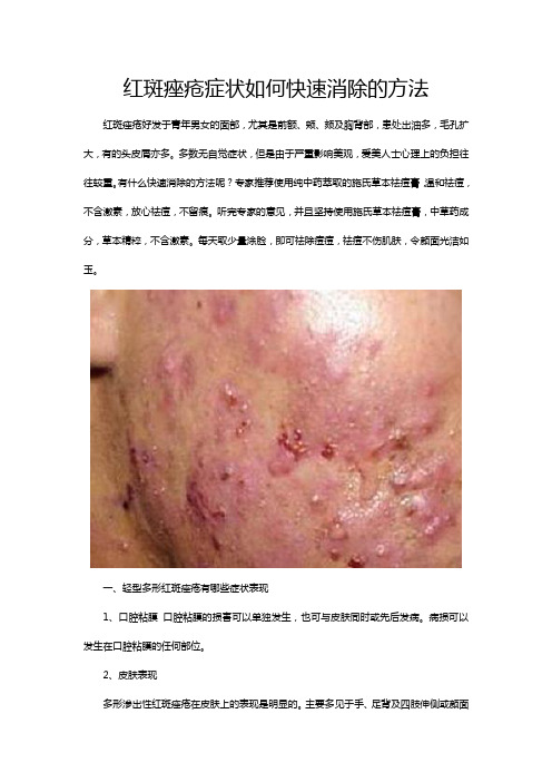 红斑痤疮症状如何快速消除的方法