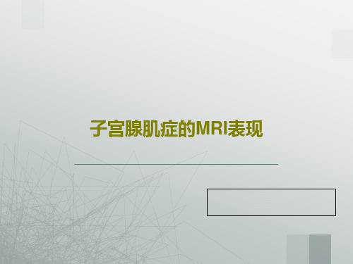 子宫腺肌症的MRI表现共32页