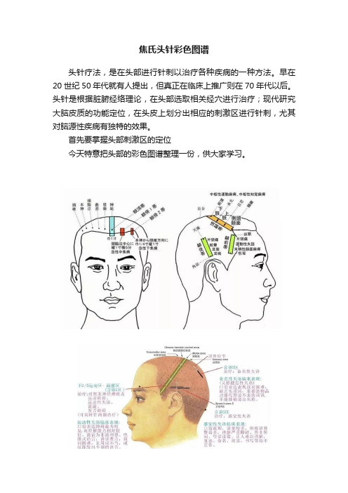 焦氏头针彩色图谱