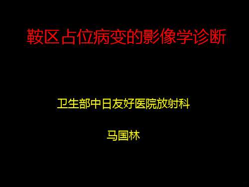 鞍区占位病变(鞍内)PPT课件