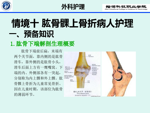 肱骨髁上骨折病人护理