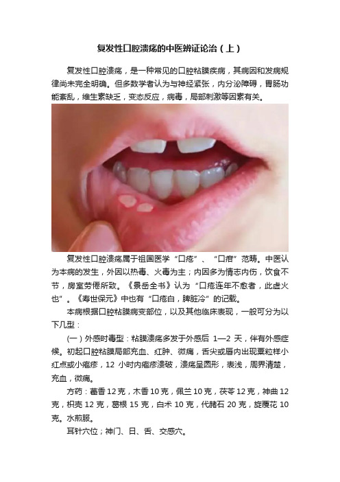 复发性口腔溃疡的中医辨证论治（上）
