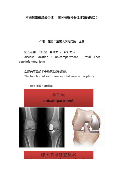 不求最贵但求最合适---膝关节置换假体该如何选择？