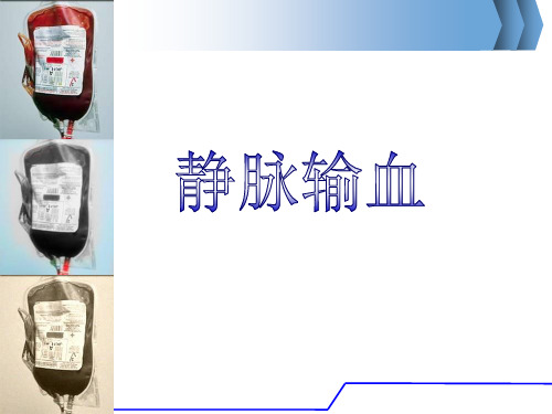 静脉输血  ppt课件