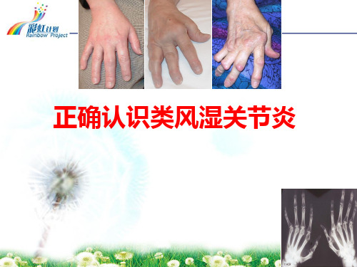 RA的诊治