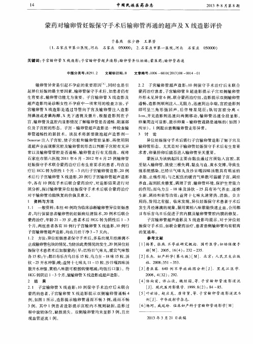 蒙药对输卵管妊娠保守手术后输卵管再通的超声及x线造影评价