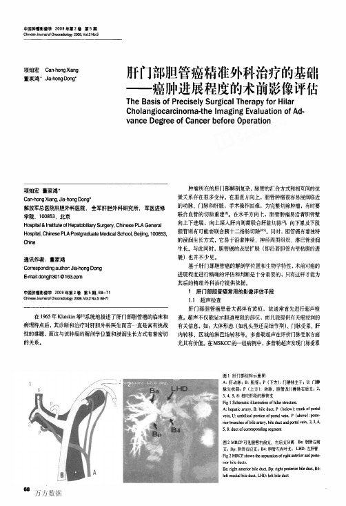 肝门部胆管癌精准外科治疗的基础——癌肿进展程度的术前影像评估