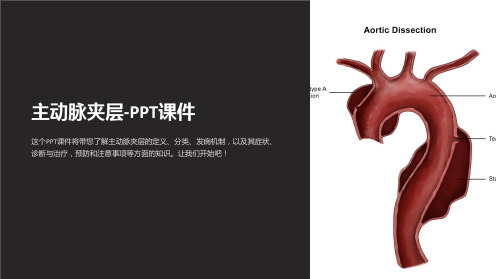 主动脉夹层-课件