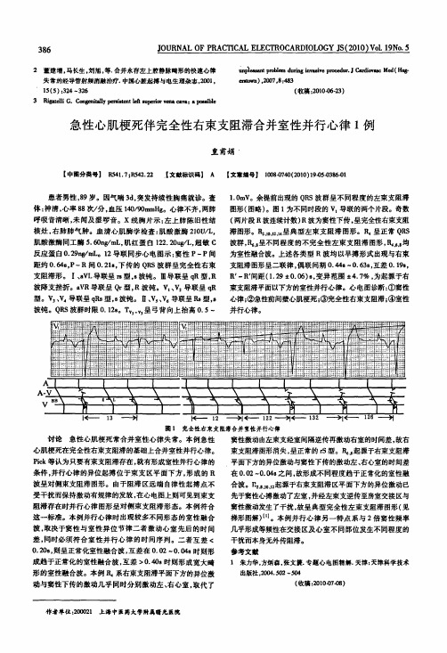 急性心肌梗死伴完全性右束支阻滞合并室性并行心律1例