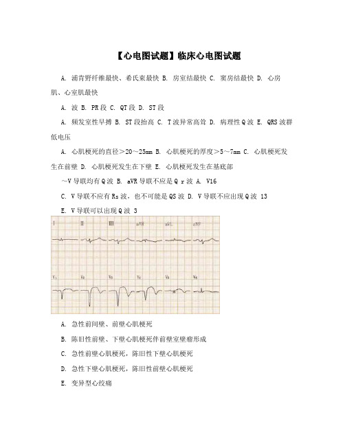 【心电图试题】临床心电图试题
