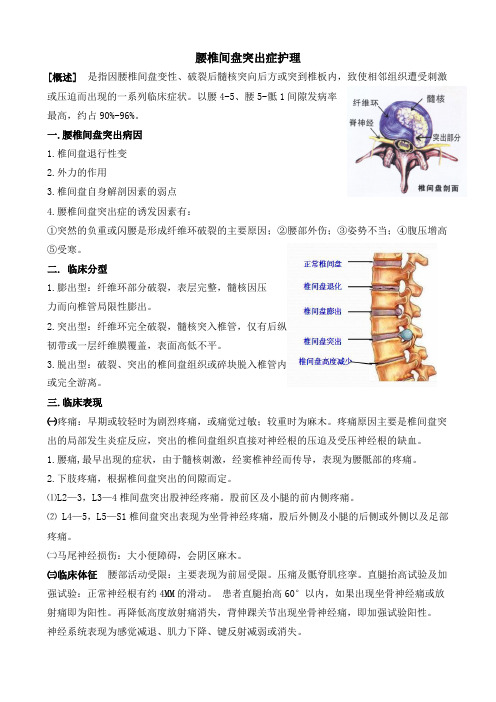 腰椎间盘突出症护理