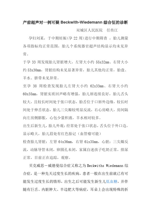 Beckwith-Wiedemann综合征